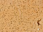 NCOA6 Antibody in Immunohistochemistry (Paraffin) (IHC (P))