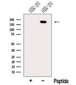 NCOA6 Antibody in Western Blot (WB)