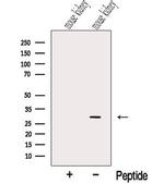 NIT2 Antibody in Western Blot (WB)