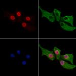 NALP1 Antibody in Immunocytochemistry (ICC/IF)