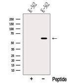 NOP58 Antibody in Western Blot (WB)