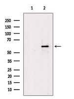 NOP58 Antibody in Western Blot (WB)