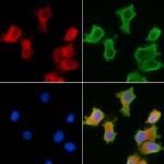 NPLOC4 Antibody in Immunocytochemistry (ICC/IF)