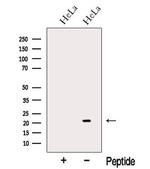 NUDT16 Antibody in Western Blot (WB)