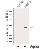 NUDT9 Antibody in Western Blot (WB)