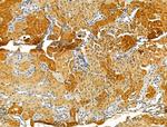 OCIAD1 Antibody in Immunohistochemistry (Paraffin) (IHC (P))