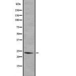 GEM Antibody in Western Blot (WB)