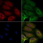 NDUFB6 Antibody in Immunocytochemistry (ICC/IF)