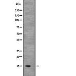 NDUFB6 Antibody in Western Blot (WB)