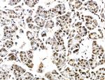 PDP2 Antibody in Immunohistochemistry (Paraffin) (IHC (P))