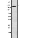 SCN3A Antibody in Western Blot (WB)