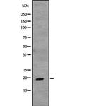 TCAP Antibody in Western Blot (WB)