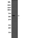 TSEN2 Antibody in Western Blot (WB)