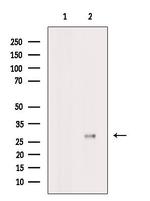 ATP6V1D Antibody in Western Blot (WB)