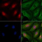 Cyclin T2 Antibody in Immunocytochemistry (ICC/IF)