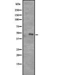 CD177 Antibody in Western Blot (WB)