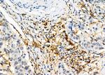 CD97 Antibody in Immunohistochemistry (Paraffin) (IHC (P))