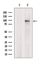 CD97 Antibody in Western Blot (WB)