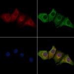 CENPJ Antibody in Immunocytochemistry (ICC/IF)