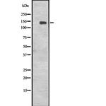 CENPJ Antibody in Western Blot (WB)