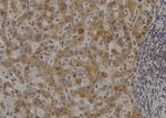 NIK Antibody in Immunohistochemistry (Paraffin) (IHC (P))