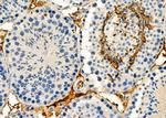 NIK Antibody in Immunohistochemistry (Paraffin) (IHC (P))