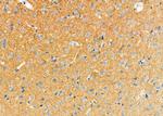 NIK Antibody in Immunohistochemistry (Paraffin) (IHC (P))