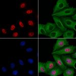 SIVA1 Antibody in Immunocytochemistry (ICC/IF)