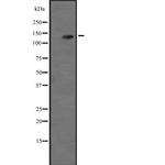 Adenylate Cyclase 3 Antibody in Western Blot (WB)