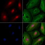 GADD45B Antibody in Immunocytochemistry (ICC/IF)