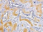 Laminin beta-3 Antibody in Immunohistochemistry (Paraffin) (IHC (P))