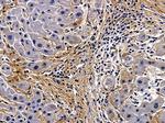 Laminin beta-3 Antibody in Immunohistochemistry (Paraffin) (IHC (P))