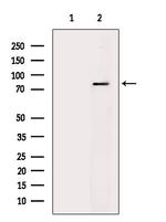 ZNF750 Antibody in Western Blot (WB)