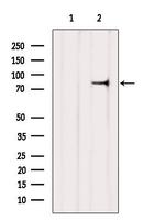 ZNF750 Antibody in Western Blot (WB)