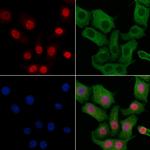 SNAPC4 Antibody in Immunocytochemistry (ICC/IF)