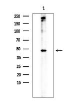 JMJD2D Antibody in Western Blot (WB)