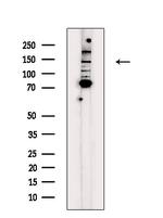 MYOCD Antibody in Western Blot (WB)