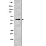 ZNF768 Antibody in Western Blot (WB)