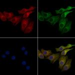 TCHP Antibody in Immunocytochemistry (ICC/IF)