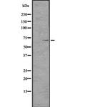 TCHP Antibody in Western Blot (WB)