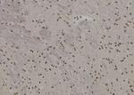 BACH2 Antibody in Immunohistochemistry (Paraffin) (IHC (P))