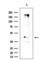 BACH2 Antibody in Western Blot (WB)