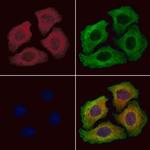 TRIM31 Antibody in Immunocytochemistry (ICC/IF)