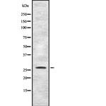 FGFBP1 Antibody in Western Blot (WB)