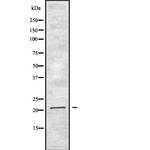 Interferon alpha-2 Antibody in Western Blot (WB)