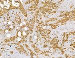 Interferon alpha-4/10/14 Antibody in Immunohistochemistry (Paraffin) (IHC (P))