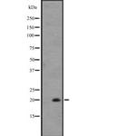 IL-25 Antibody in Western Blot (WB)