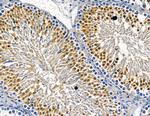 IFI35 Antibody in Immunohistochemistry (Paraffin) (IHC (P))