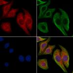 CD49a Antibody in Immunocytochemistry (ICC/IF)