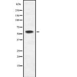 KRT6B/KRT6C Antibody in Western Blot (WB)